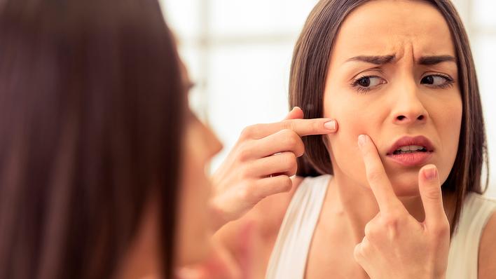 La dieta, el cigarrillo y los maquillajes, entre otros,  pueden predisponer la aparición de esta enfermedad que muchas veces se extiende una vez atravesada la adolescencia.