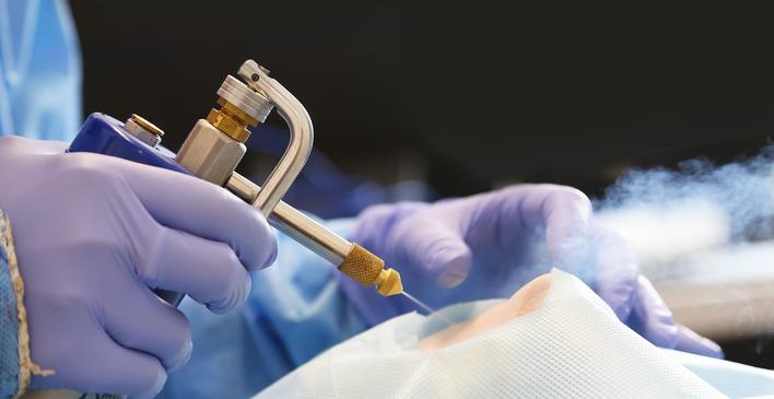 El Servicio de Dermatología de nuestro Hospital cuenta con el equipamiento para la realización de esta práctica, recomendada especialmente para adultos mayores y niños,  por  ser rápida y prácticamente indolora.