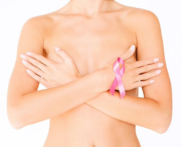 La extirpación quirúrgica de una o ambas mamas por cáncer tiene un impacto caótico en la psicología de la mujer