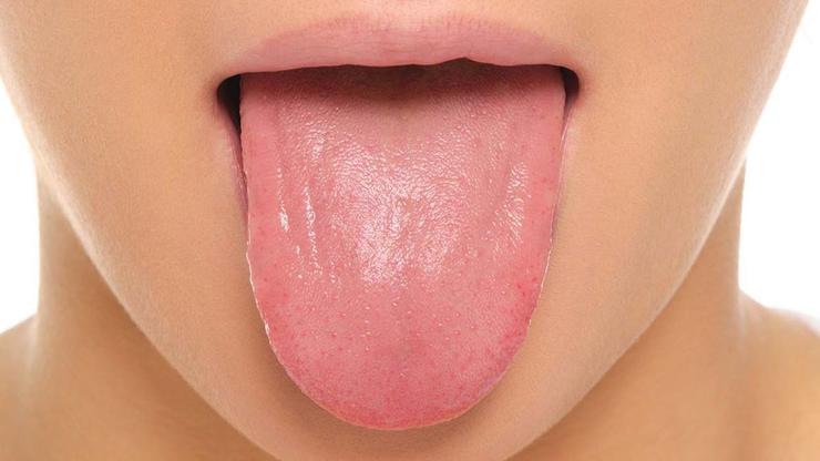 Cáncer de Boca: controles gratuitos para prevenirlo